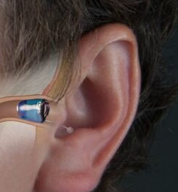 Dispositif intra auriculaire dans une oreille